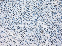 TTP Antibody (OTI8B5), Novus Biologicals 0.1mL; Unlabeled:Antibodies, Monoclonal