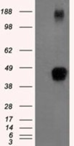TTP Antibody (OTI8B5), Novus Biologicals 0.1mL; Unlabeled:Antibodies, Monoclonal