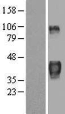 Novus Biologicals&trade;&nbsp;TTP Overexpression Lysate
