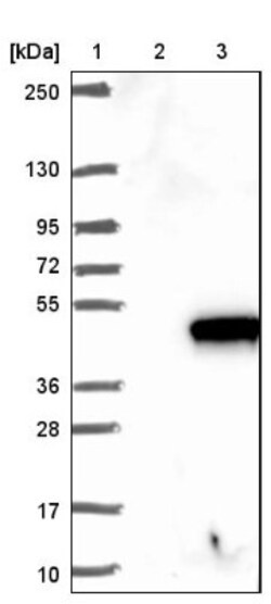 TTPAL Antibody, Novus Biologicals:Antibodies:Primary Antibodies