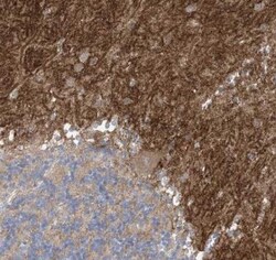 TTYH1 Antibody, Novus Biologicals 25 &mu;L | Buy Online | Novus Biologicals | Fisher Scientific