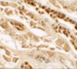 TTYH2 Antibody - BSA Free, Novus Biologicals 0.1mg; Unlabeled:Antibodies,