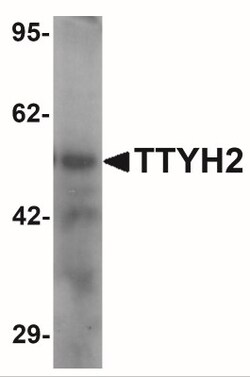 TTYH2 Antibody - BSA Free, Novus Biologicals 0.1mg; Unlabeled:Antibodies,