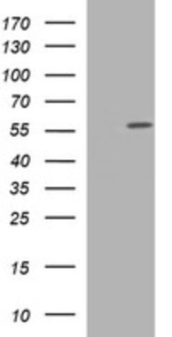TUBA6 Antibody (OTI1D8), Novus Biologicals 0.1mL; Unlabeled:Antibodies,