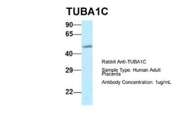 TUBA6 Antibody, Novus Biologicals 100 &mu;L | Buy Online | Novus Biologicals | Fisher Scientific