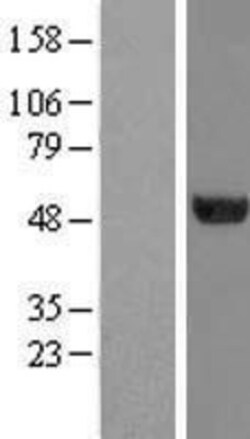 Novus Biologicals™ TUBA6 Overexpression Lysate