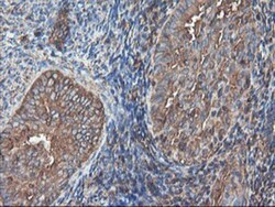 TUBAL3 Antibody (OTI4C5), Novus Biologicals 0.1mL; Unlabeled:Antibodies,