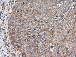 TUBAL3 Antibody (OTI4C5), Novus Biologicals 0.1mL; Unlabeled:Antibodies,
