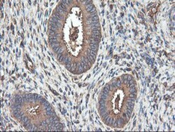 TUBAL3 Antibody (OTI4C5), Novus Biologicals 0.1mL; Unlabeled:Antibodies,