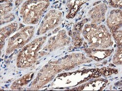 TUBAL3 Antibody (OTI4C5), Novus Biologicals 0.1mL; Unlabeled:Antibodies,