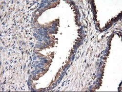 TUBAL3 Antibody (OTI4C5), Novus Biologicals 0.1mL; Unlabeled:Antibodies,