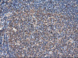 TUBAL3 Antibody (OTI4C5), Novus Biologicals 0.1mL; Unlabeled:Antibodies,