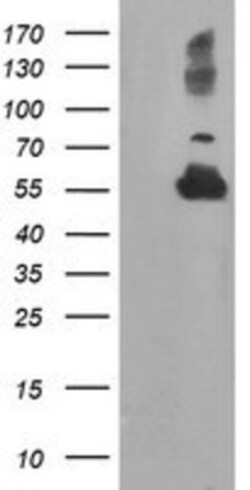 TUBAL3 Antibody (OTI4C5), Novus Biologicals 0.1mL; Unlabeled:Antibodies,