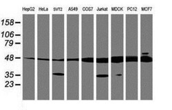 TUBAL3 Antibody (OTI4C5), Novus Biologicals 0.1mL; Unlabeled:Antibodies,