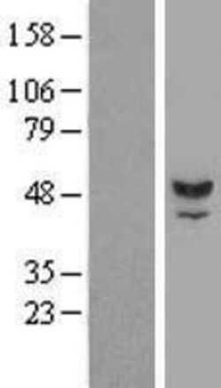 Novus Biologicals&trade;&nbsp;TUBAL3 Overexpression Lysate