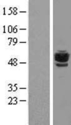 Novus Biologicals™ TUBB6 Overexpression Lysate