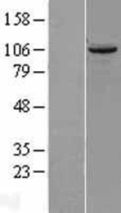 Novus Biologicals&trade;&nbsp;TUBGCP2 Overexpression Lysate