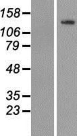 Novus Biologicals&trade;&nbsp;TUBGCP5 Overexpression Lysate