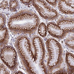 TUBGCP6 Antibody, Novus Biologicals 25 &mu;L | Buy Online | Novus Biologicals | Fisher Scientific