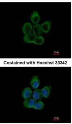 Tubulin alpha-8 Antibody, Novus Biologicals 0.1mg; Unlabeled:Antibodies,