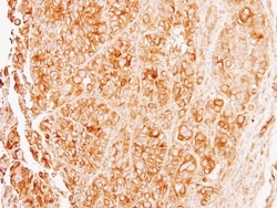 Tubulin alpha-8 Antibody, Novus Biologicals 0.1mg; Unlabeled:Antibodies,