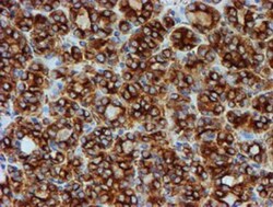 Tubulin Beta 4 Antibody (OTI3F1), Novus Biologicals 0.1mL; Unlabeled:Antibodies,