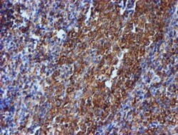 Tubulin Beta 4 Antibody (OTI3F1), Novus Biologicals 0.1mL; Unlabeled:Antibodies,