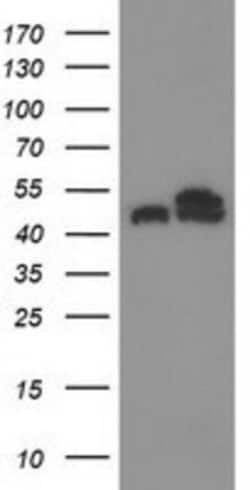 Tubulin Beta 4 Antibody (OTI3F1), Novus Biologicals 0.1mL; Unlabeled:Antibodies,