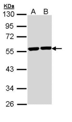 Tubulin alpha-8 Antibody, Novus Biologicals 0.1mg; Unlabeled:Antibodies,