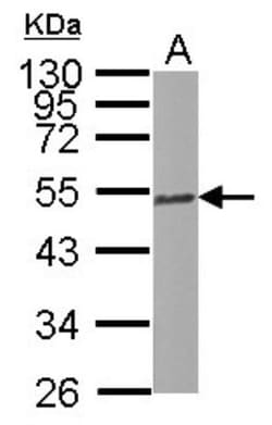 Tubulin Beta 2C Antibody, Novus Biologicals 0.1mL; Unlabeled:Antibodies,