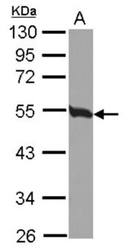 Tubulin Beta 2C Antibody, Novus Biologicals 0.1mL; Unlabeled:Antibodies,