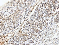 TUFM Antibody, Novus Biologicals 0.1mg; Unlabeled:Antibodies, Polyclonal