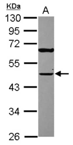TUFM Antibody, Novus Biologicals 0.1mg; Unlabeled:Antibodies, Polyclonal