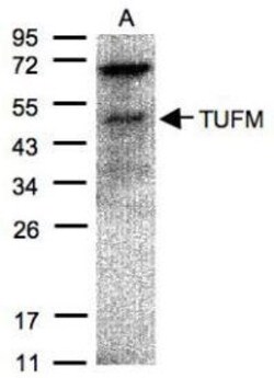 TUFM Antibody, Novus Biologicals 0.1mg; Unlabeled:Antibodies, Polyclonal