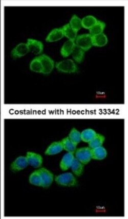TULA/STS-2 Antibody, Novus Biologicals 0.1mL; Unlabeled:Antibodies, Polyclonal