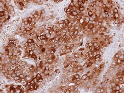 TULA/STS-2 Antibody, Novus Biologicals 0.1mL; Unlabeled:Antibodies, Polyclonal