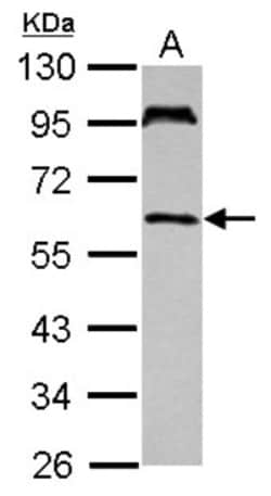 TULA/STS-2 Antibody, Novus Biologicals 0.1mL; Unlabeled:Antibodies, Polyclonal