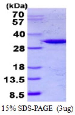 Novus Biologicals&trade;&nbsp;Recombinant Human TULP1 His Protein