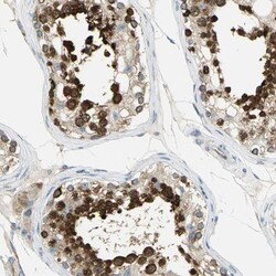 TULP4 Antibody, Novus Biologicals 0.1mL; Unlabeled:Antibodies, Polyclonal