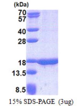 Novus Biologicals Recombinant Human TUSC2 His Protein 0.1 mg | Buy Online | Novus Biologicals&trade; | Fisher Scientific
