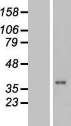 Novus Biologicals&trade;&nbsp;TUSC3 Overexpression Lysate
