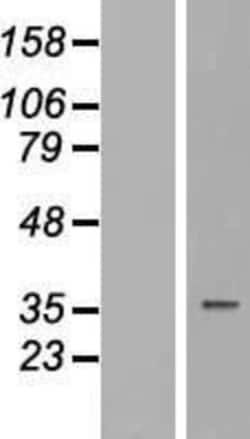 Novus Biologicals&trade;&nbsp;TUSC3 Overexpression Lysate