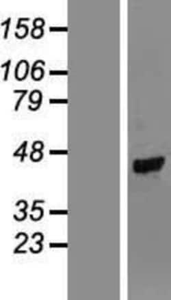 Novus Biologicals™ TUSC4 Overexpression Lysate