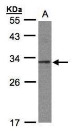 TWA1 Antibody, Novus Biologicals 0.1mg; Unlabeled:Antibodies, Polyclonal