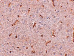 TWA1 Antibody - BSA Free, Novus Biologicals 0.1mg; Unlabeled:Antibodies,
