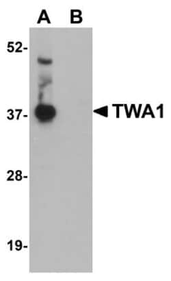TWA1 Antibody - BSA Free, Novus Biologicals 0.1mg; Unlabeled:Antibodies,