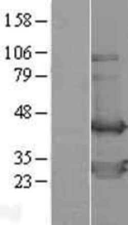 Novus Biologicals&trade;&nbsp;TWF2 Overexpression Lysate