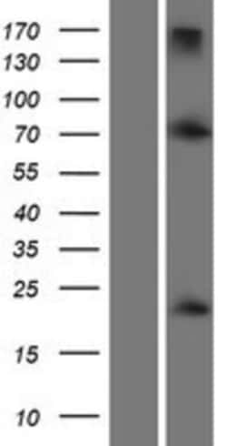 Novus Biologicals&trade;&nbsp;Twist-1 Overexpression Lysate