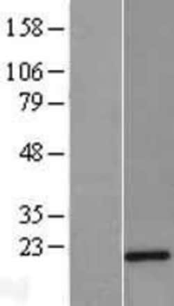Novus Biologicals™ Twist-2 Overexpression Lysate