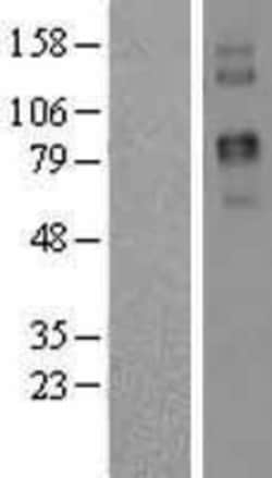 Novus Biologicals&trade;&nbsp;Two pore calcium channel protein 2 Overexpression Lysate